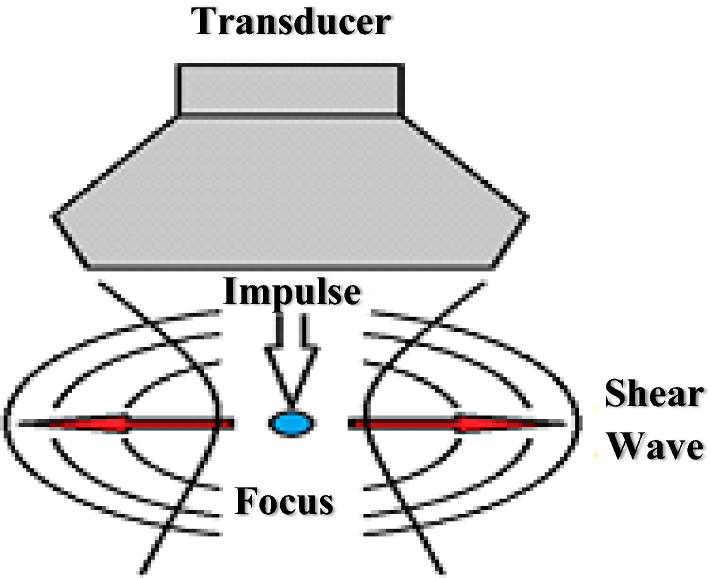 Fig. 1