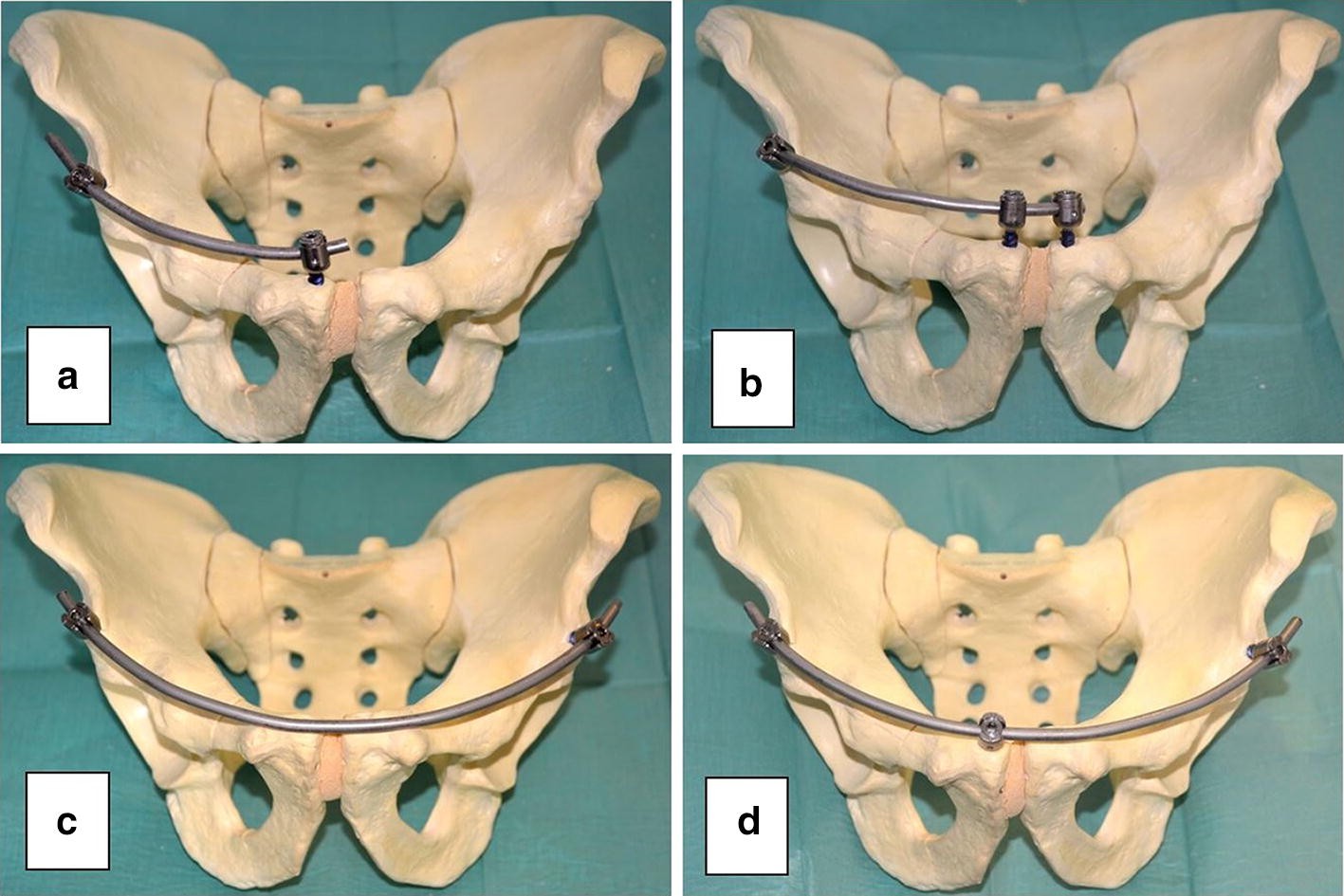 Fig. 1