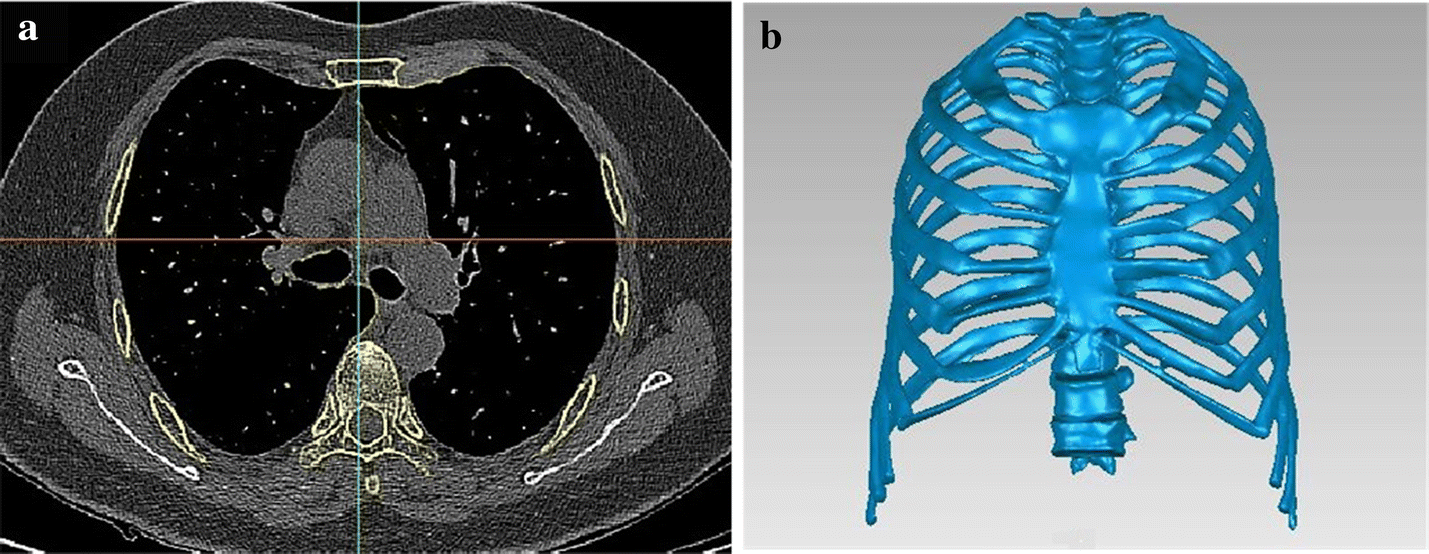 Fig. 1