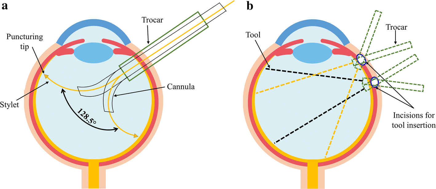 Fig. 1