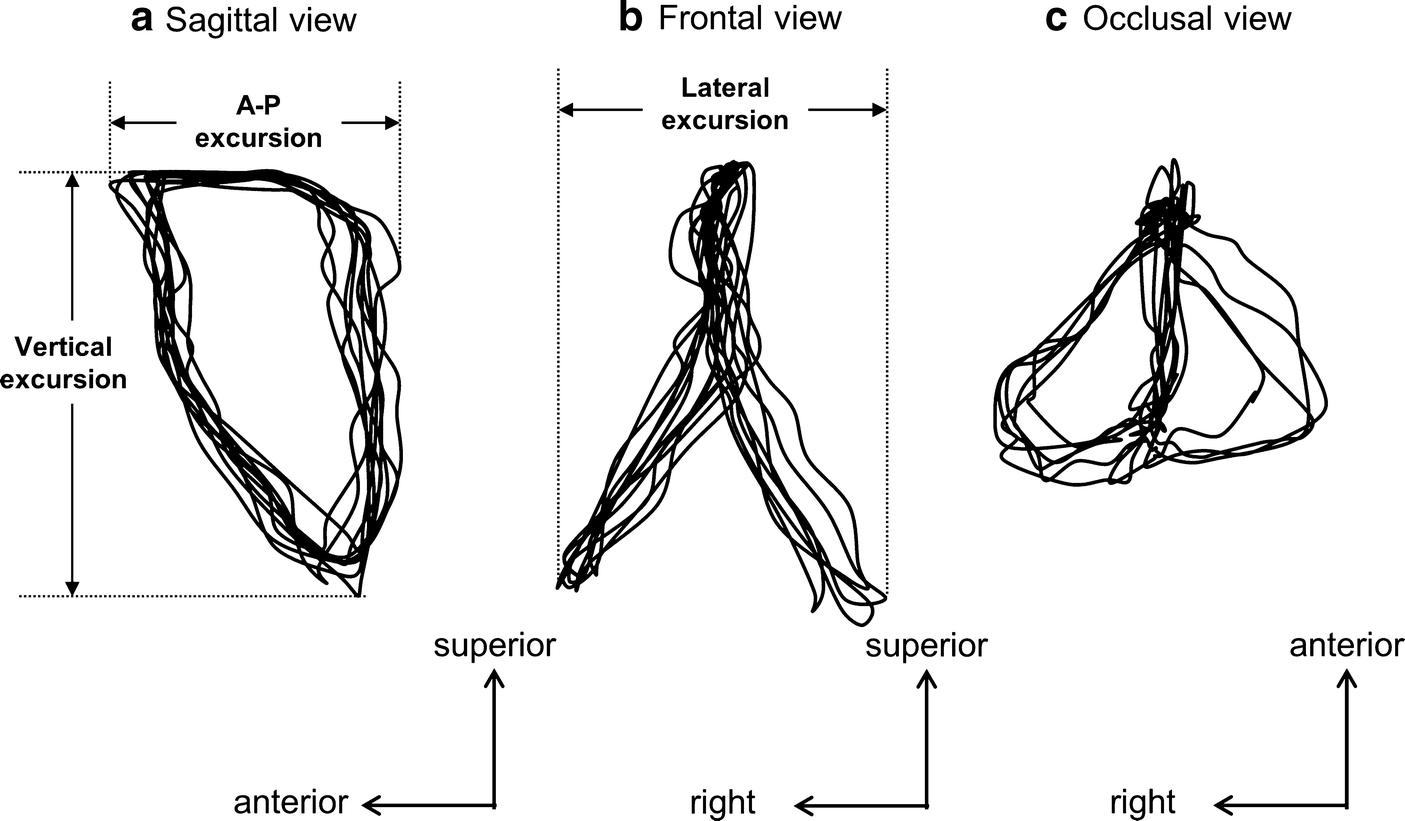 Fig. 7