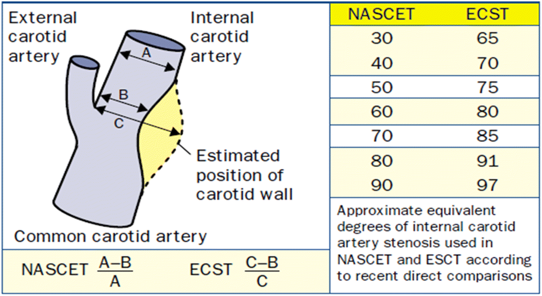 Penis calculator. Измерение степени стеноза по nascet. Оценка степени стеноза сонных артерий. Стеноз ВСА по nascet. Измерение стеноза ВСА.