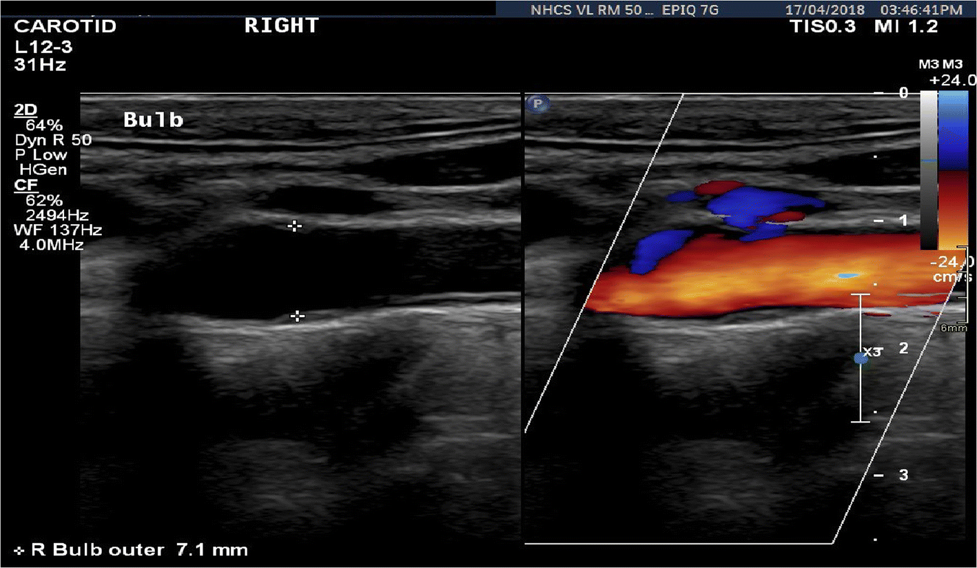 Fig. 8