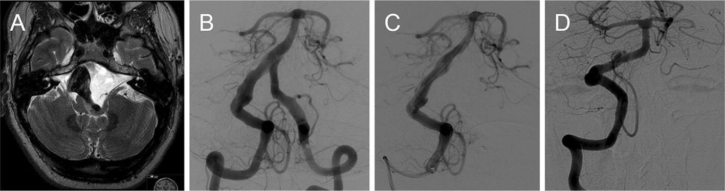 Fig. 1