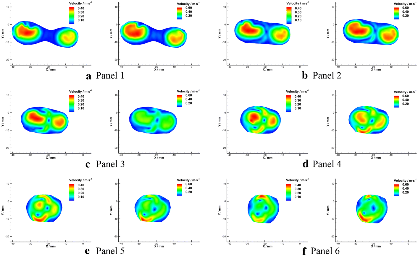 Fig. 13