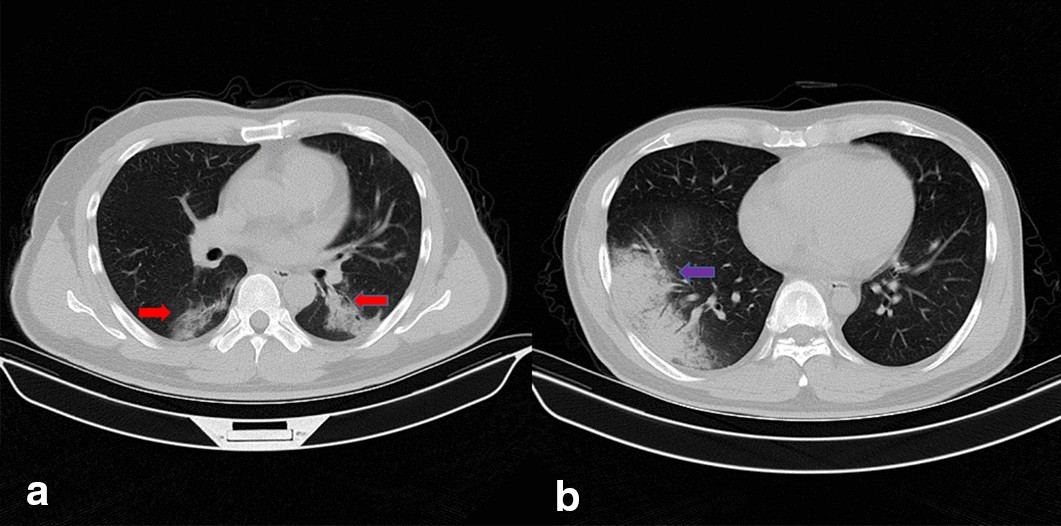 Fig. 1