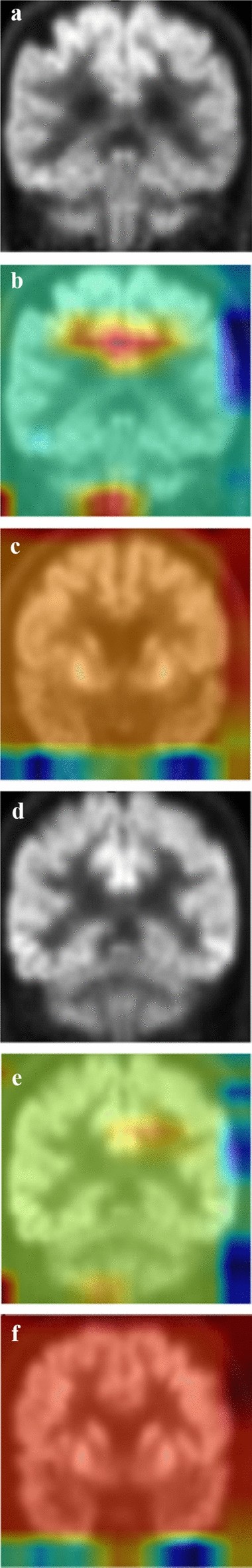 Fig. 4