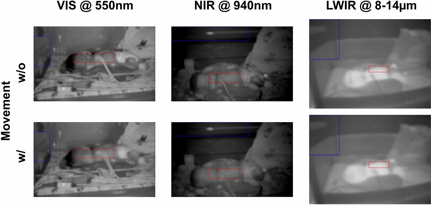 Fig. 12