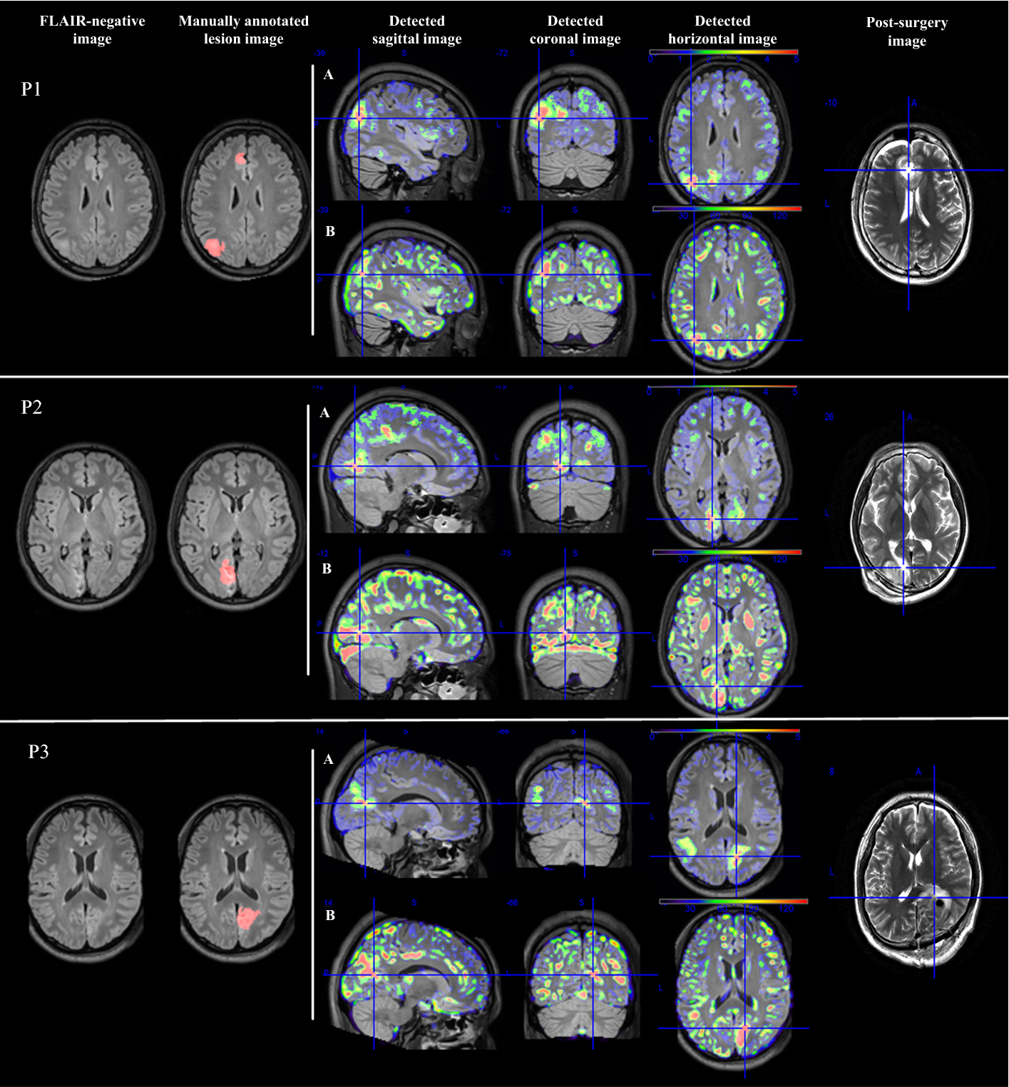 Fig. 1