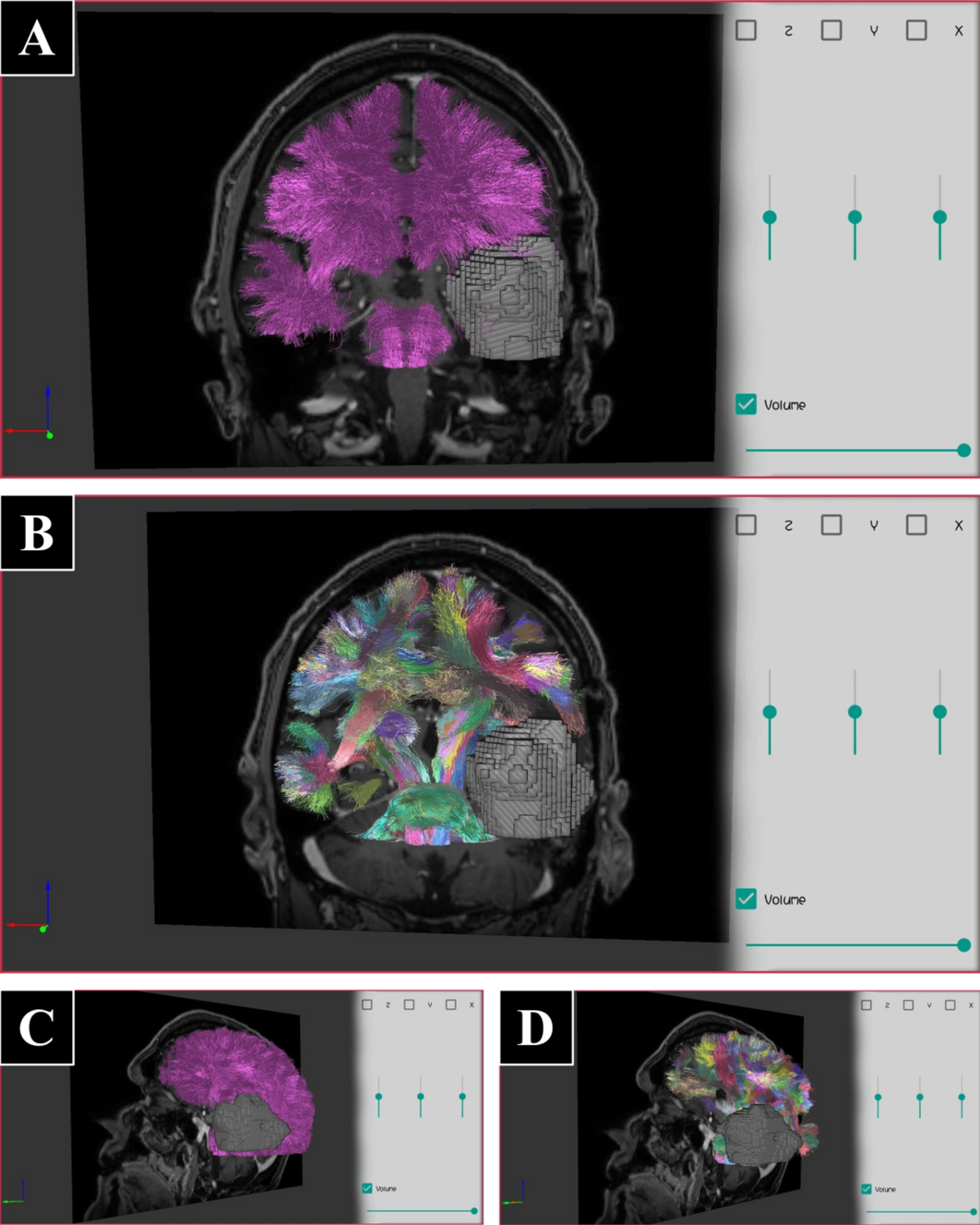 Fig. 12