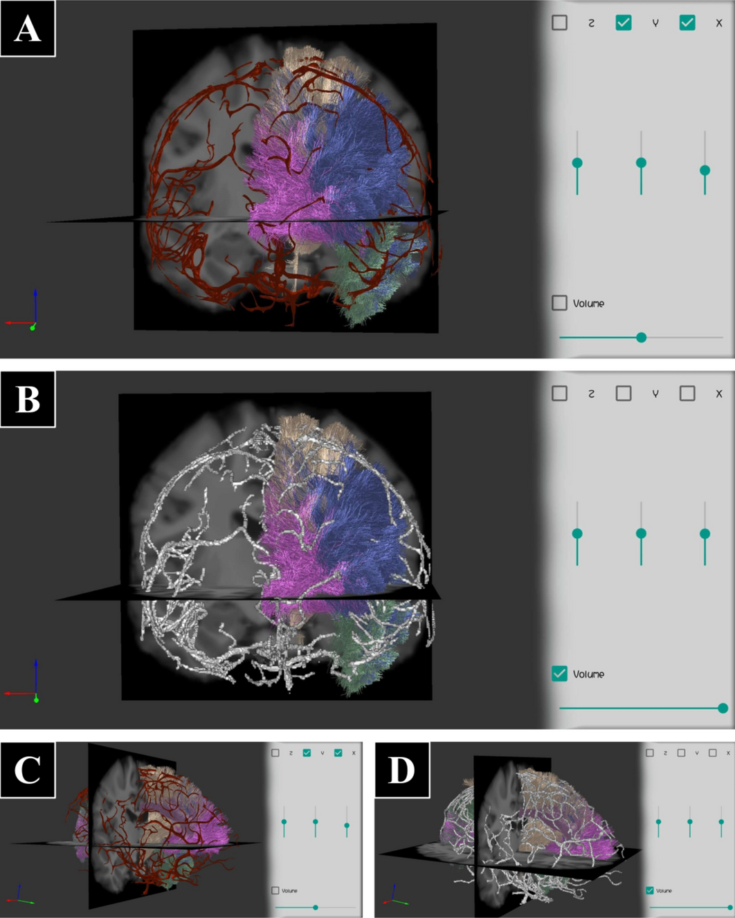 Fig. 13