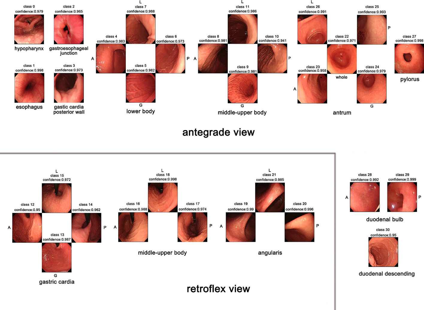 Fig. 12