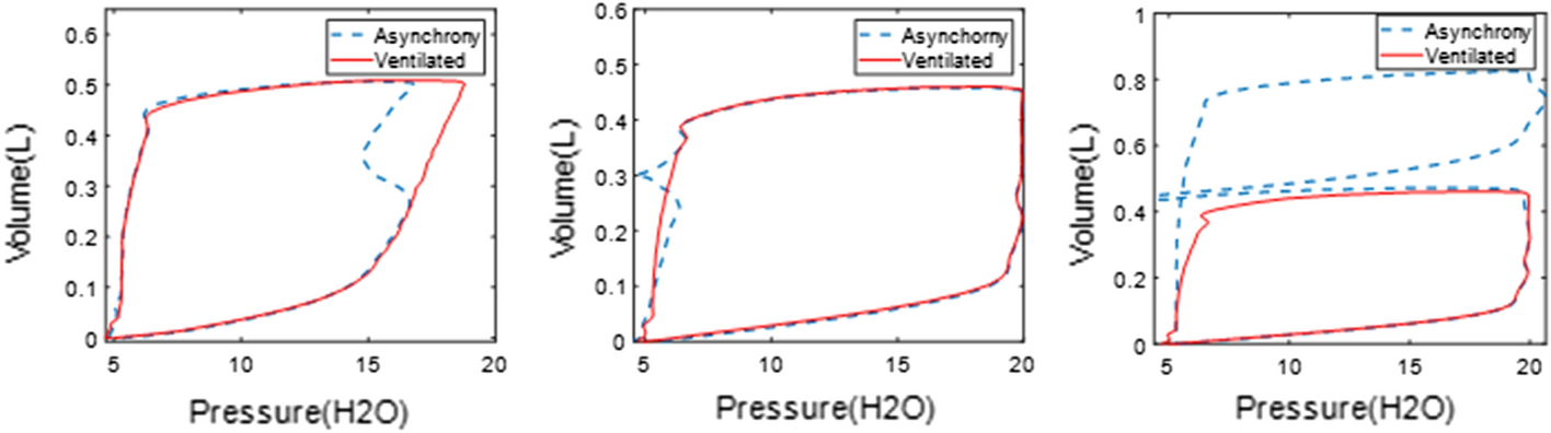 Fig. 13