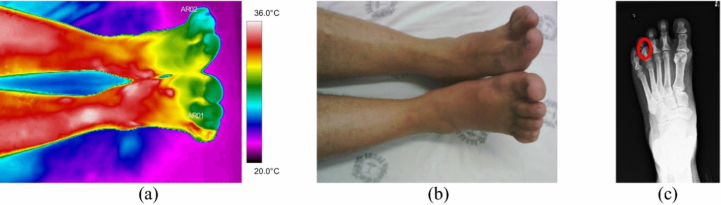 Fig. 11