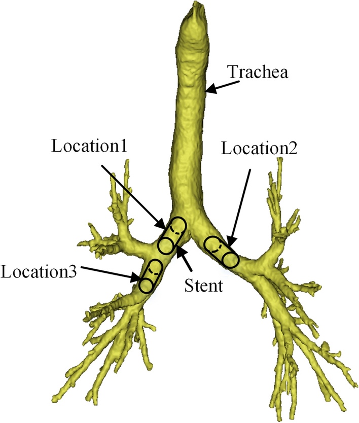 Fig. 14