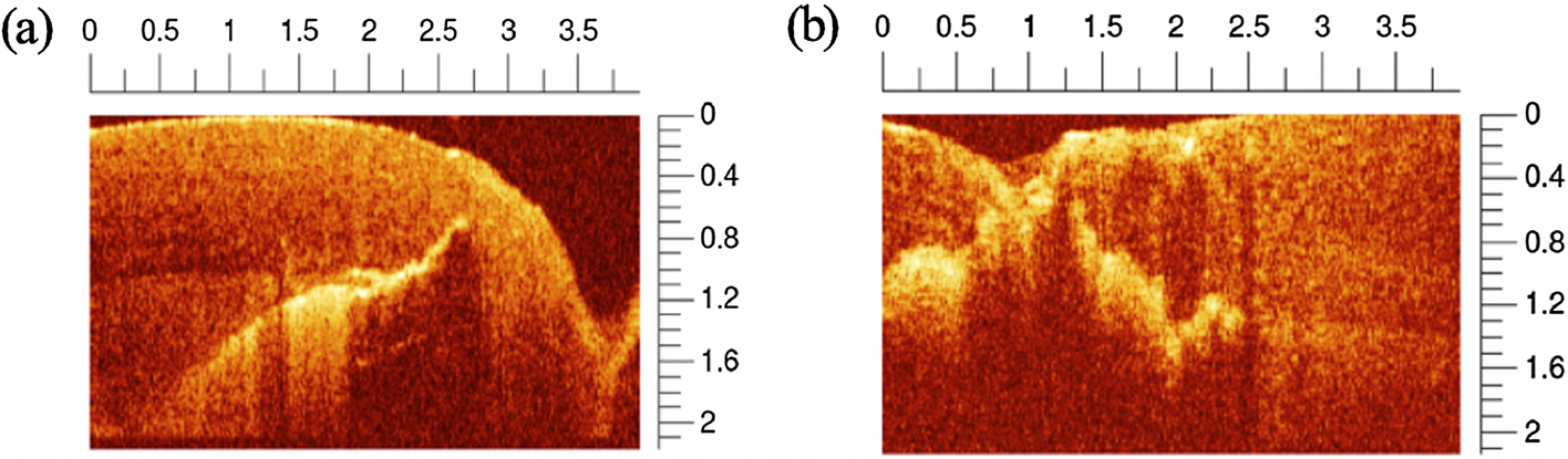 Fig. 10