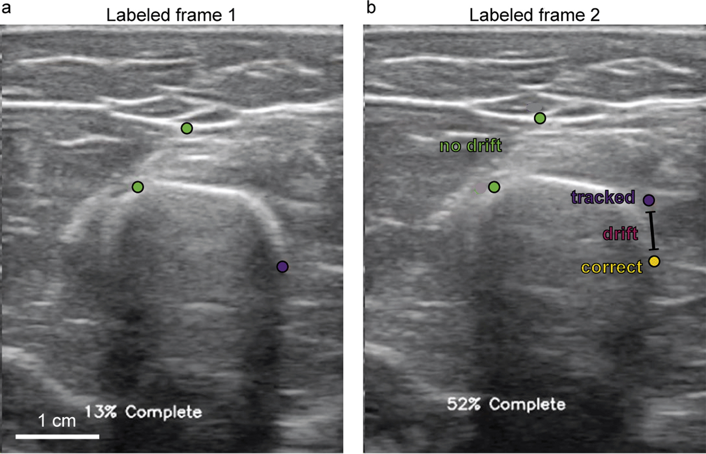 Fig. 10