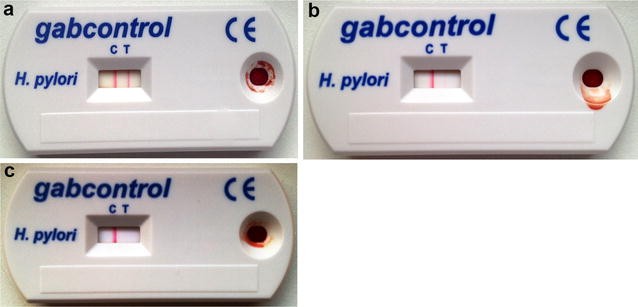 Fig. 1