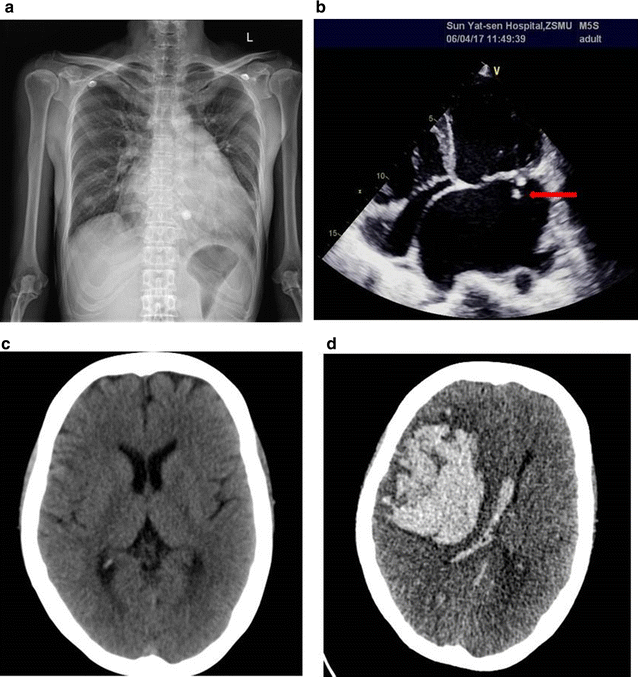 Fig. 1