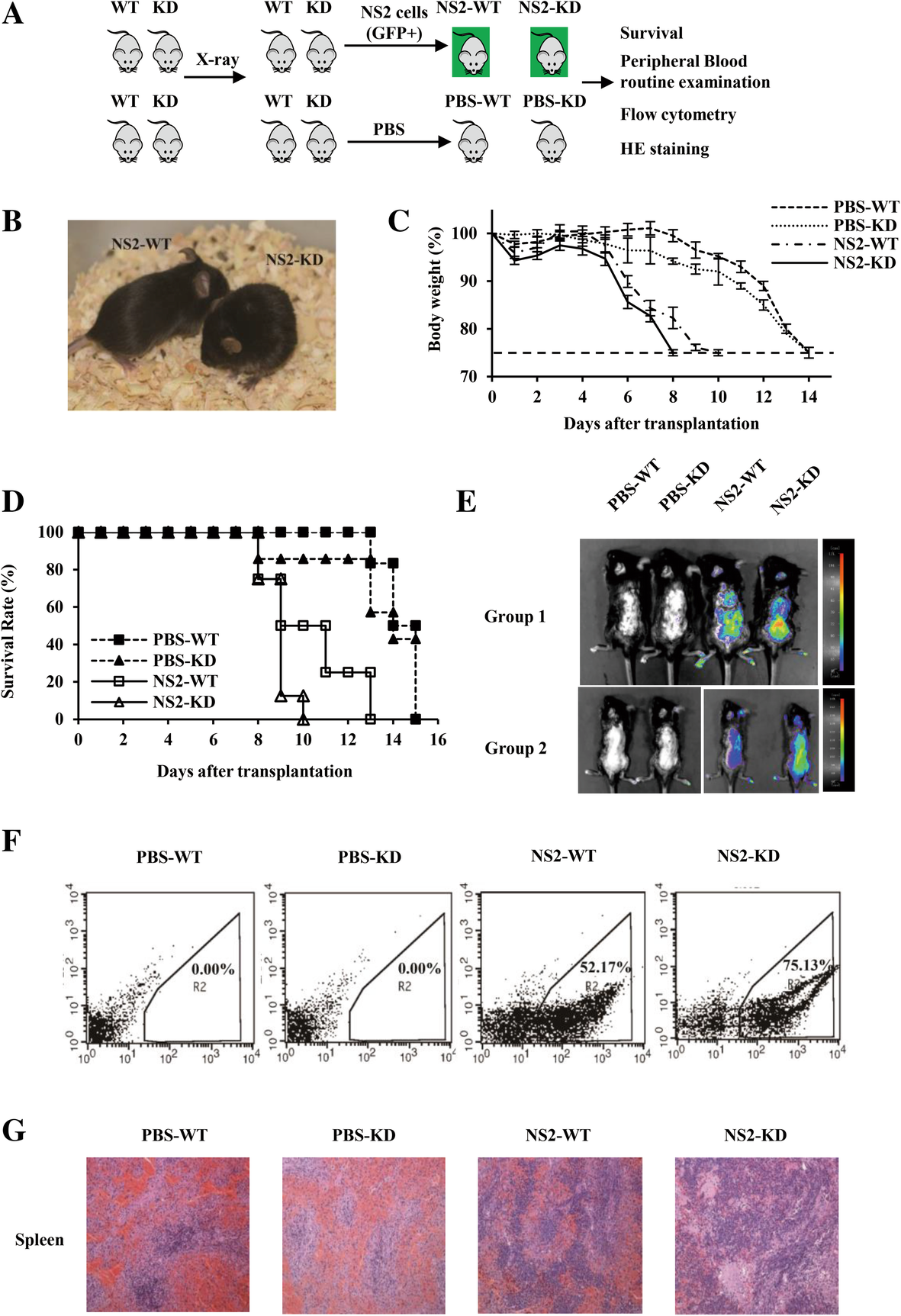 Novel lncRNA-IUR suppresses Bcr-Abl-induced tumorigenesis 