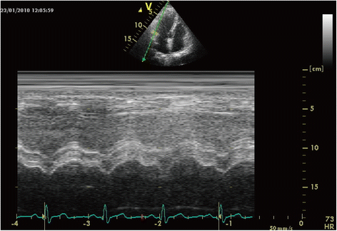 Fig. 6