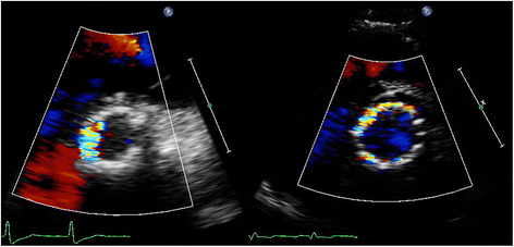 Fig. 13