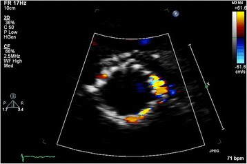 Fig. 1