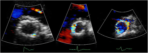 Fig. 2