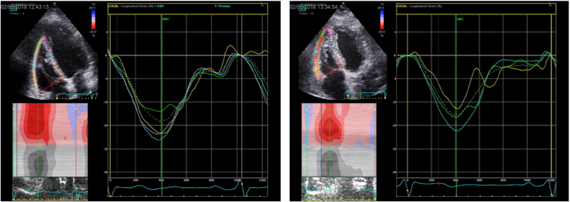 Fig. 4