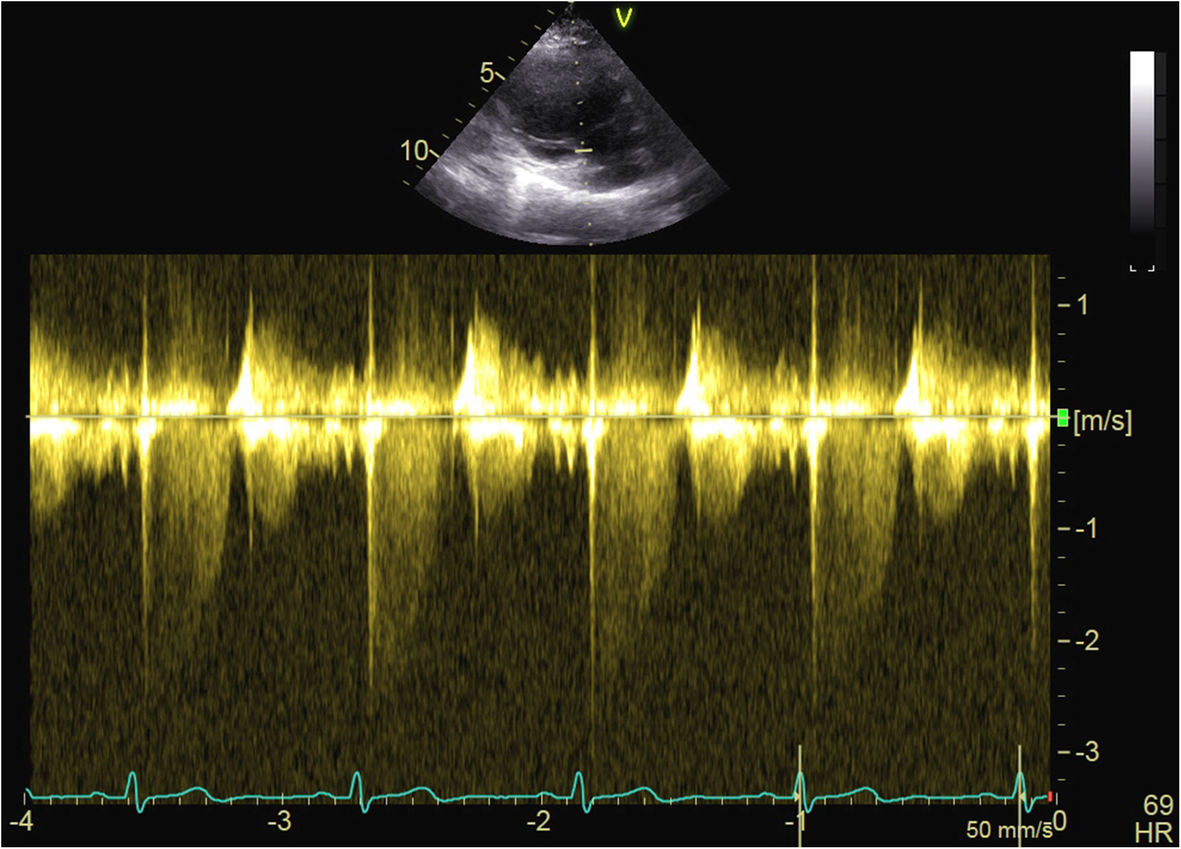 Fig. 2