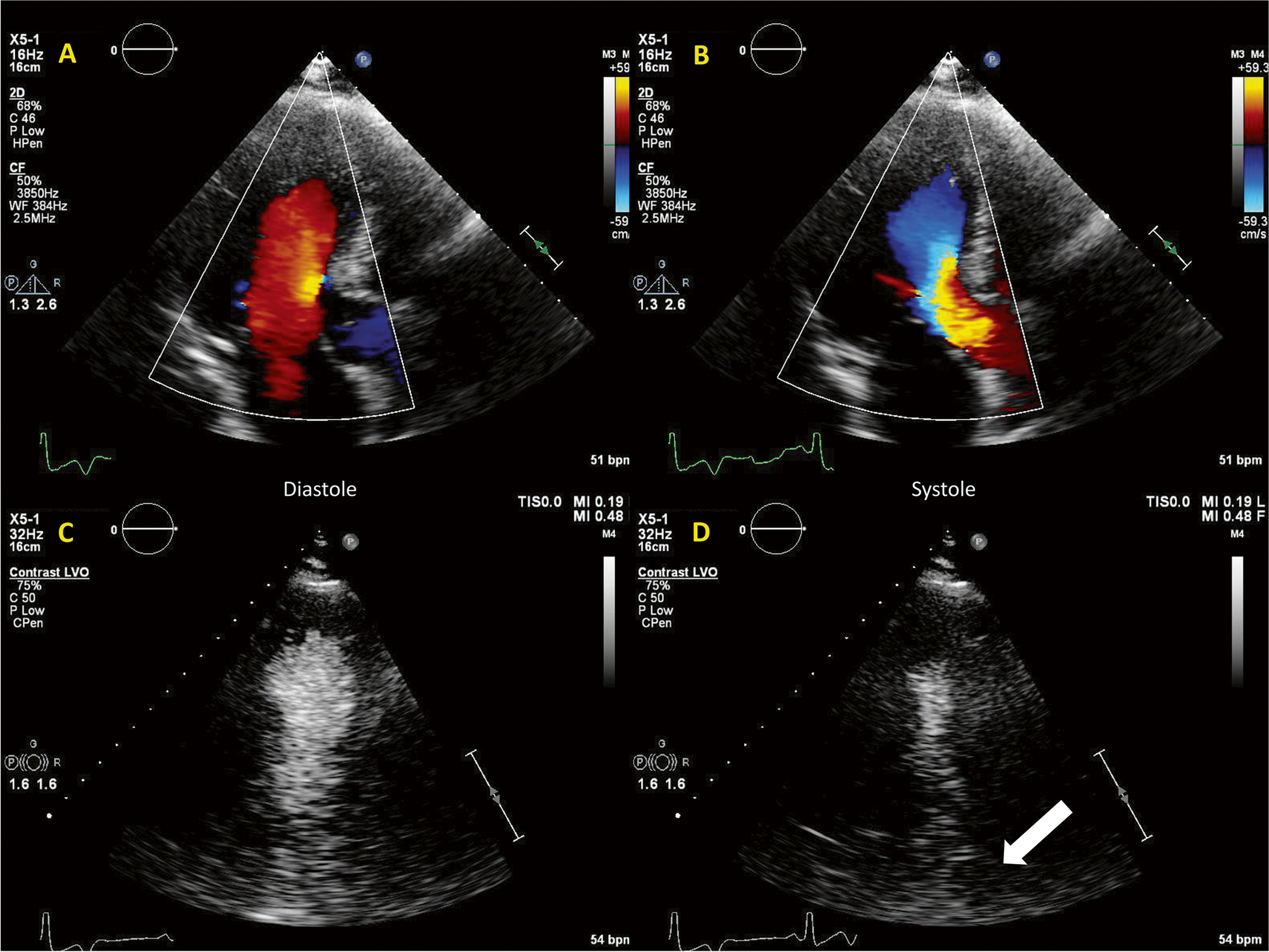 Fig. 4