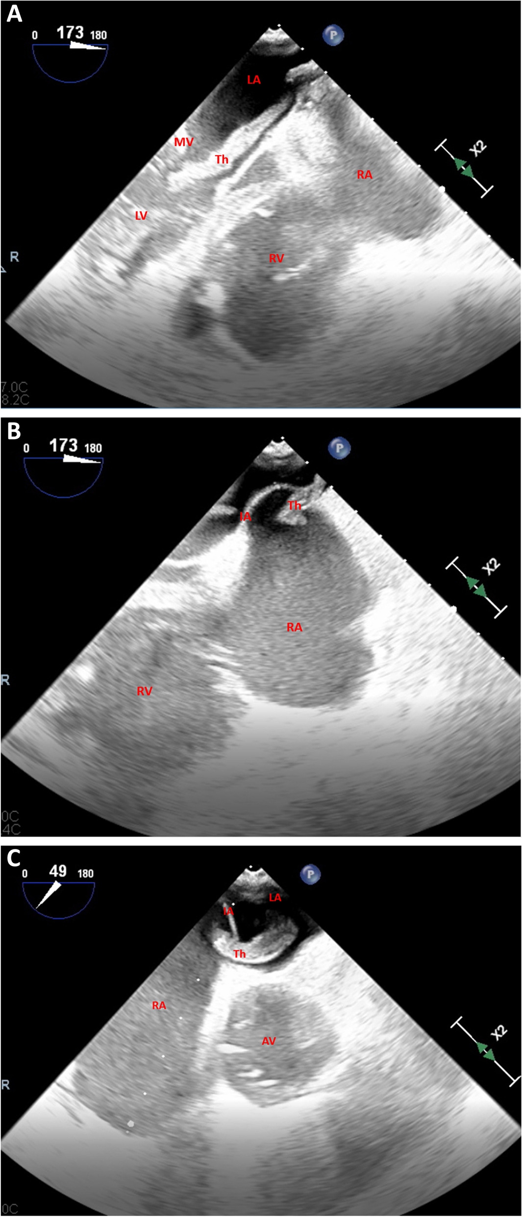 Fig. 2