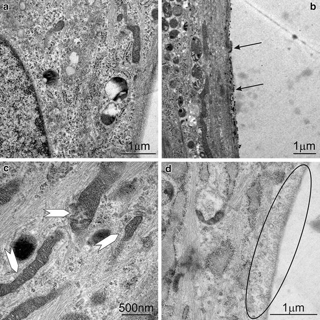 Fig. 11