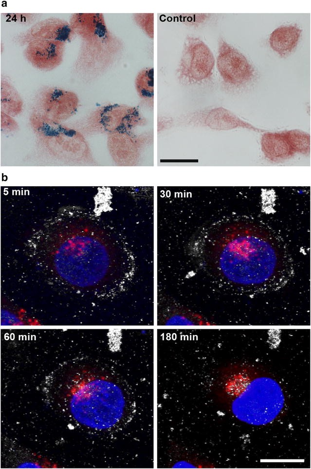 Fig. 1