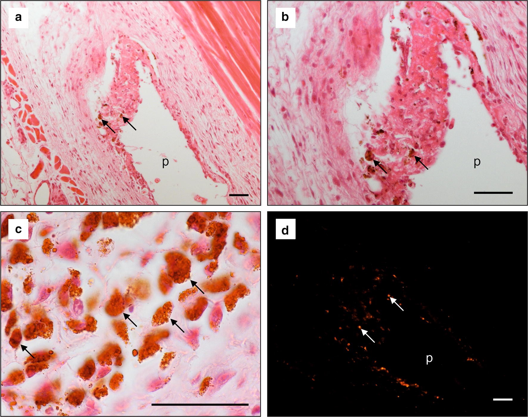 Fig. 12