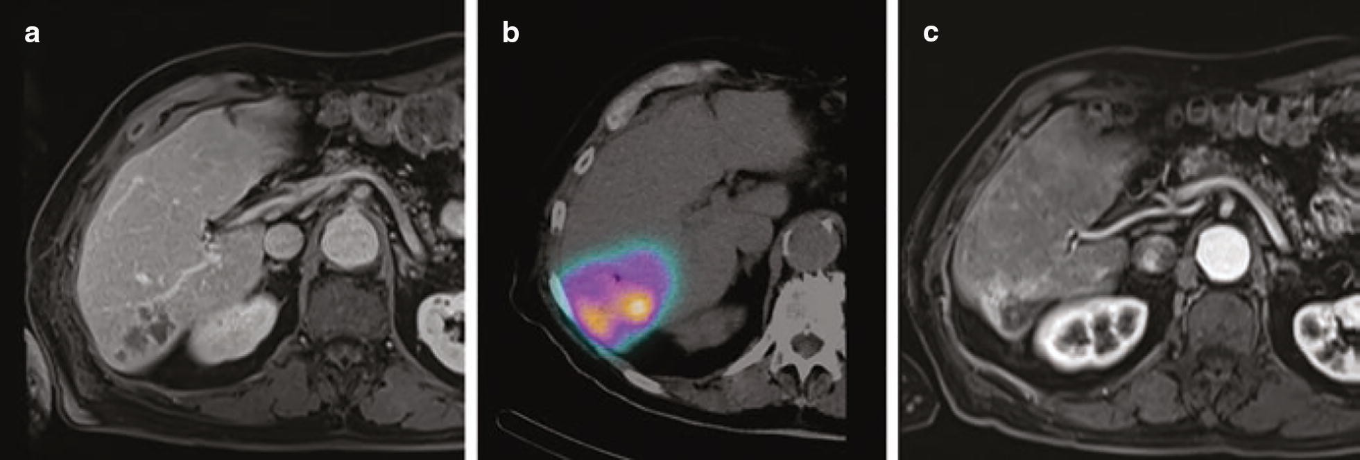 Fig. 11