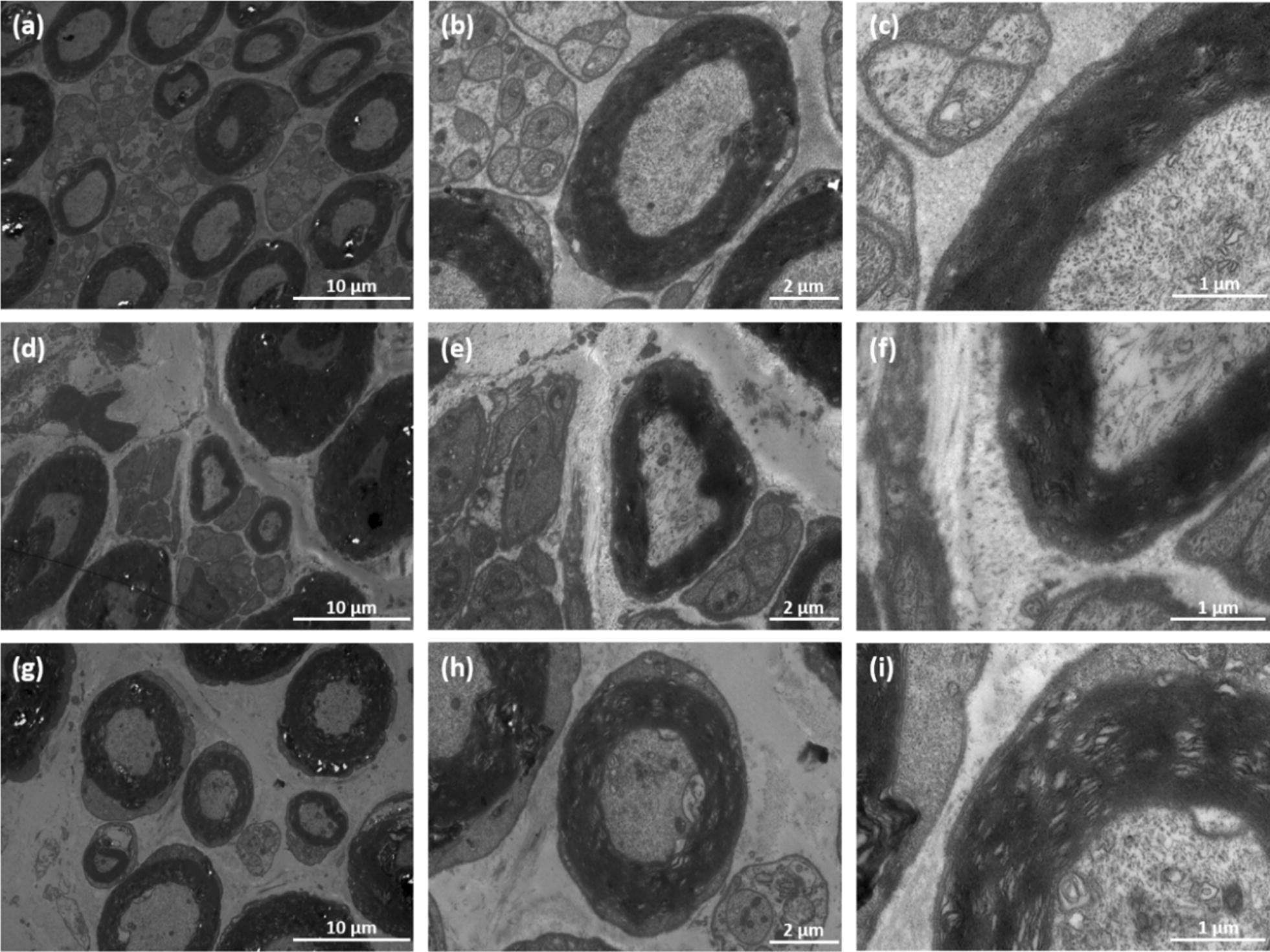 Fig. 11