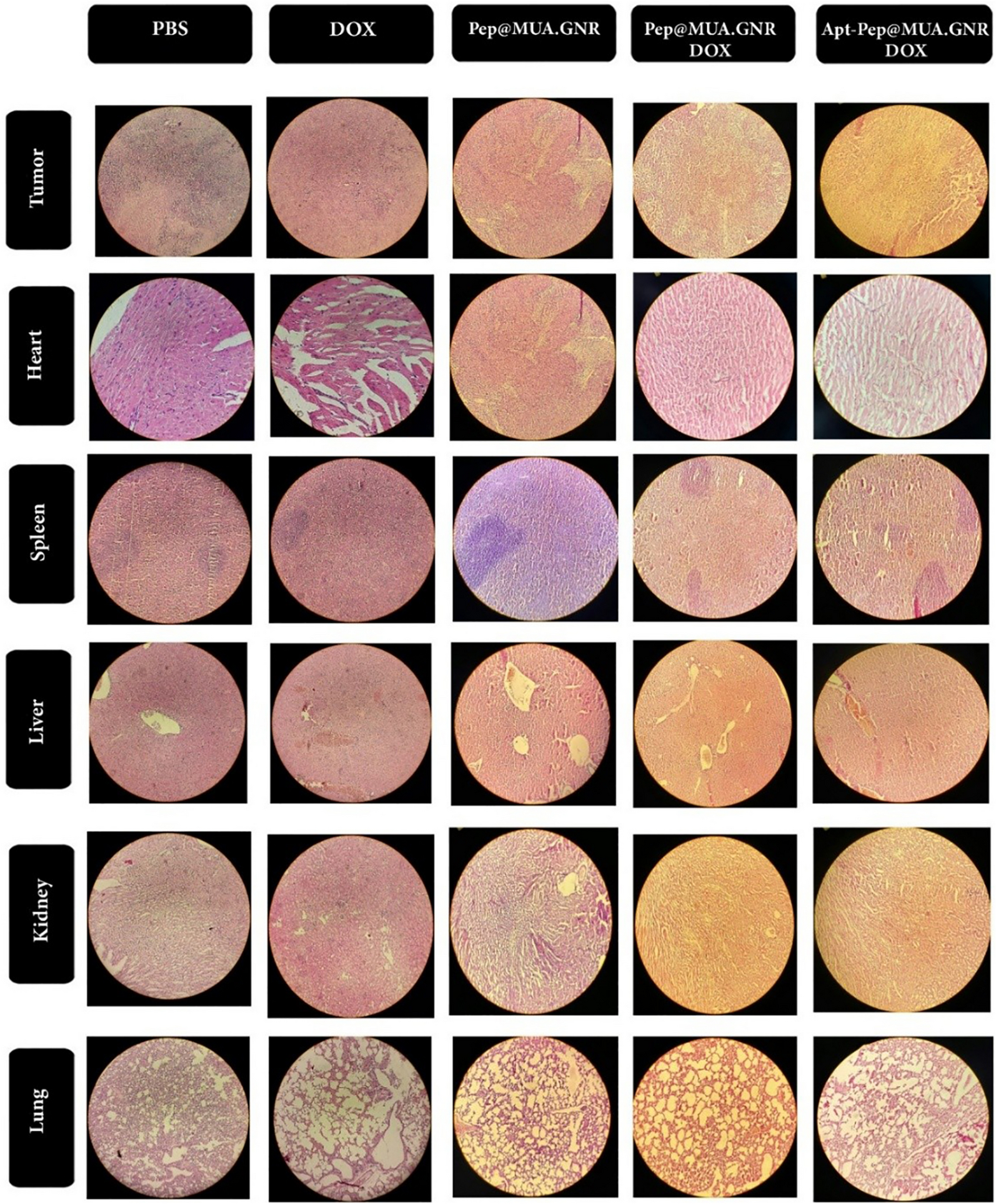 Fig. 17