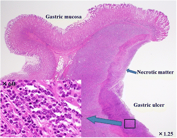 gastric ulcer histology