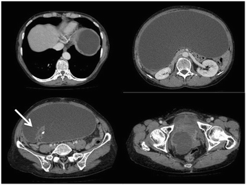 Fig. 1