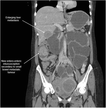 Fig. 15