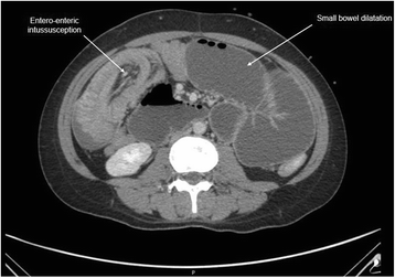 Fig. 5