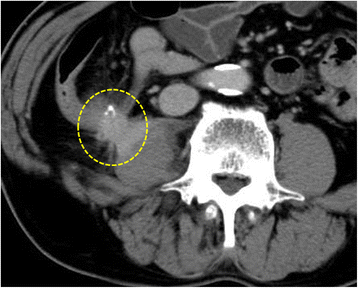 Fig. 1