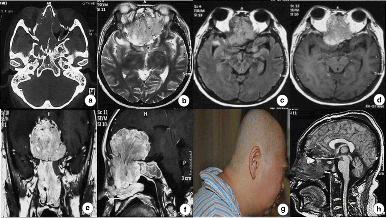 Fig. 3