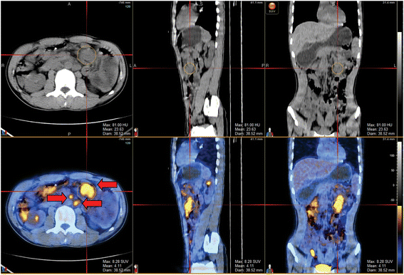 Fig. 2