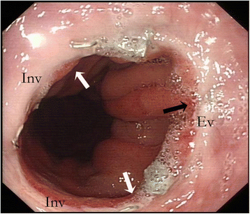 Fig. 3