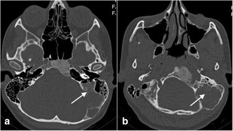 Fig. 5