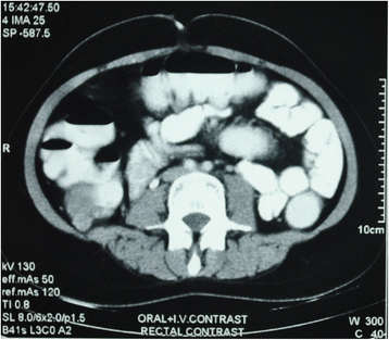 Fig. 5