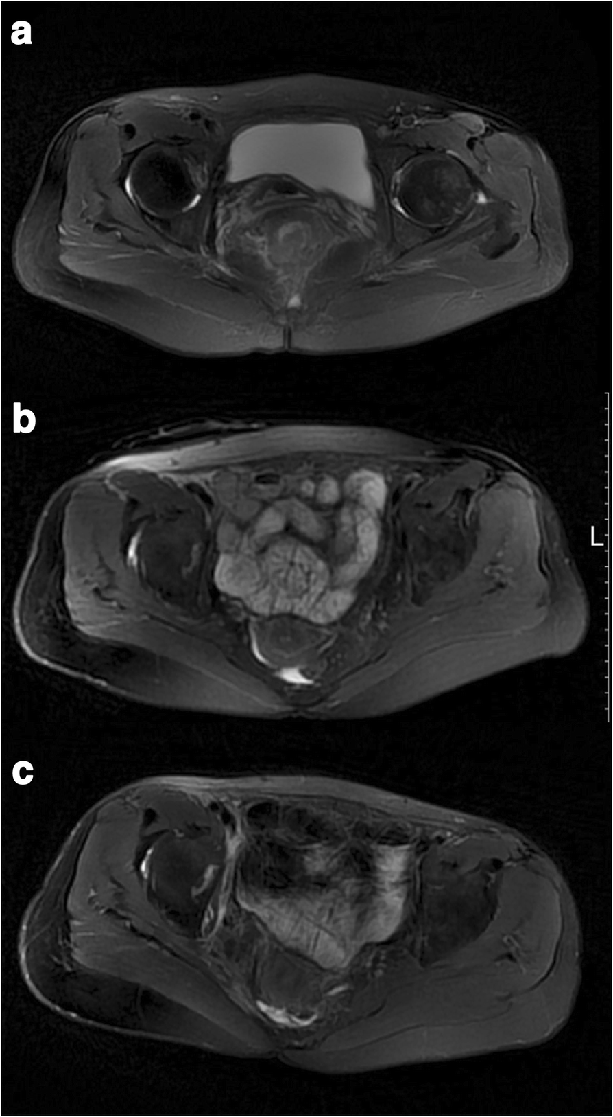 Fig. 5