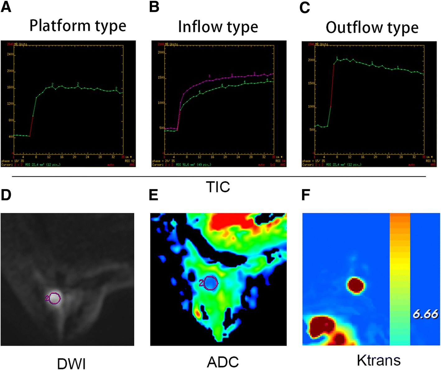 Fig. 6